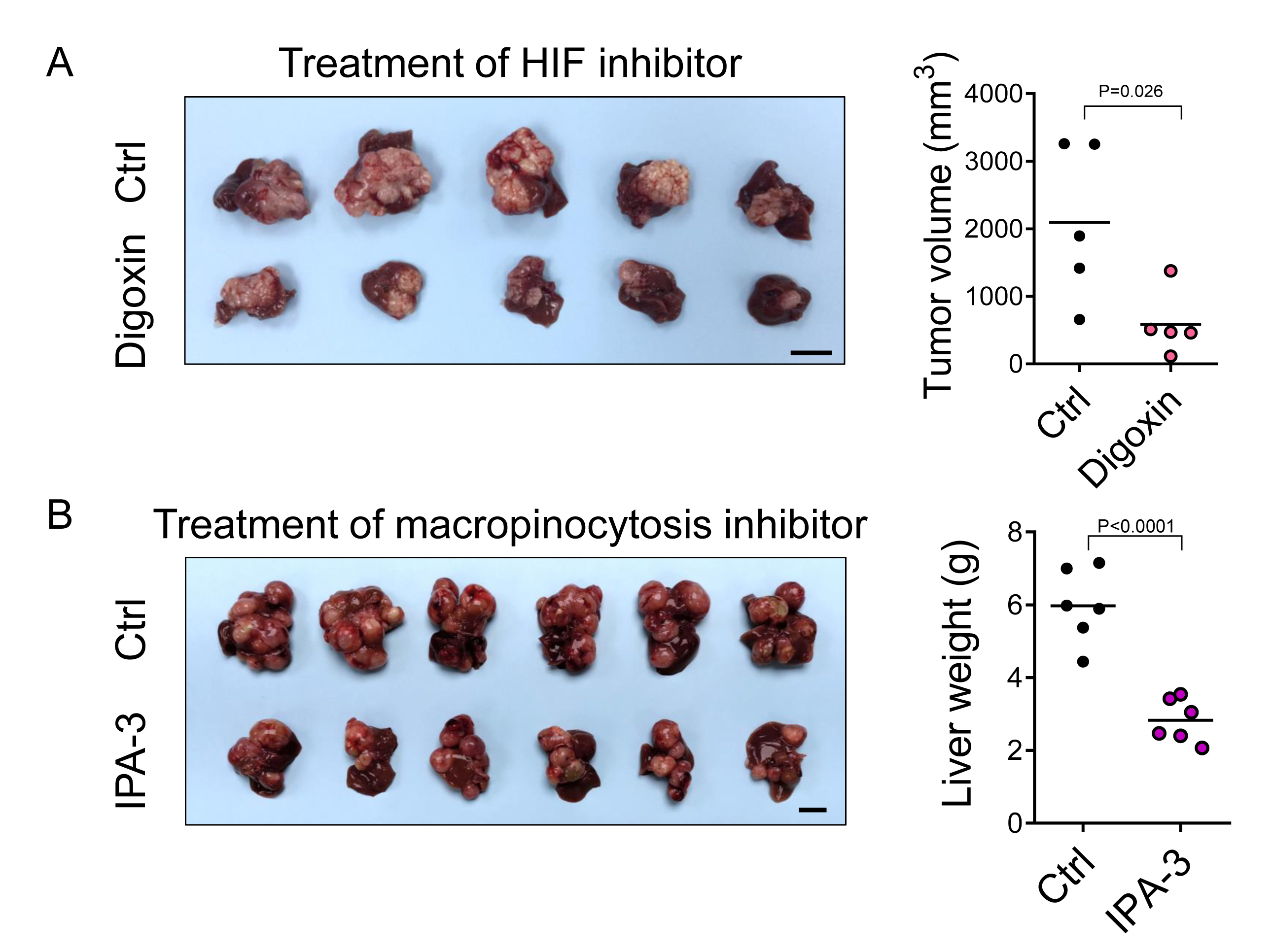 HKUMed discovers a new metabolic route for liver cancer  paving the way for new therapeutic opportunities