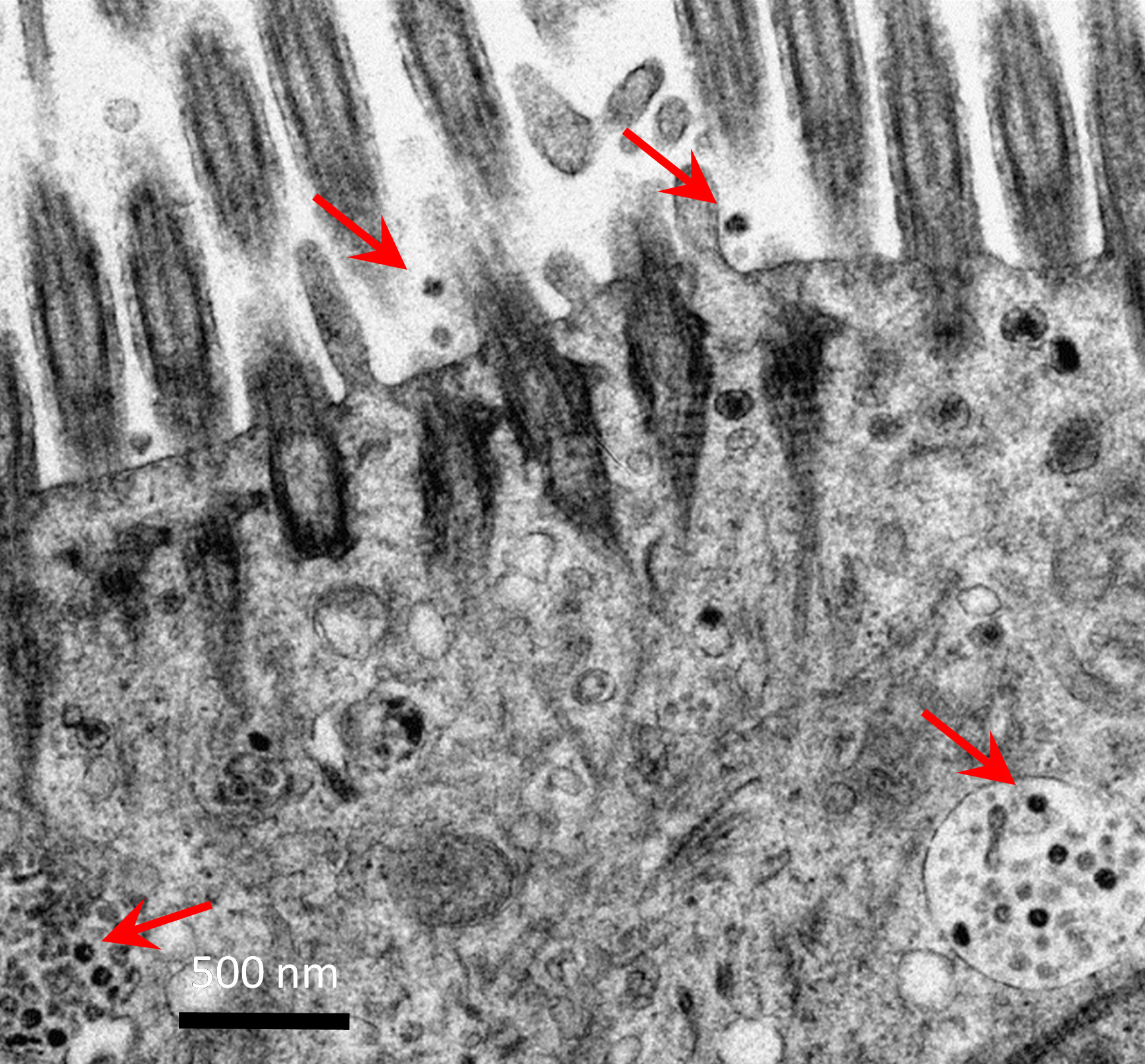 Omicron variant of SARS-CoV-2 (in red) infected human bronchus tissues.