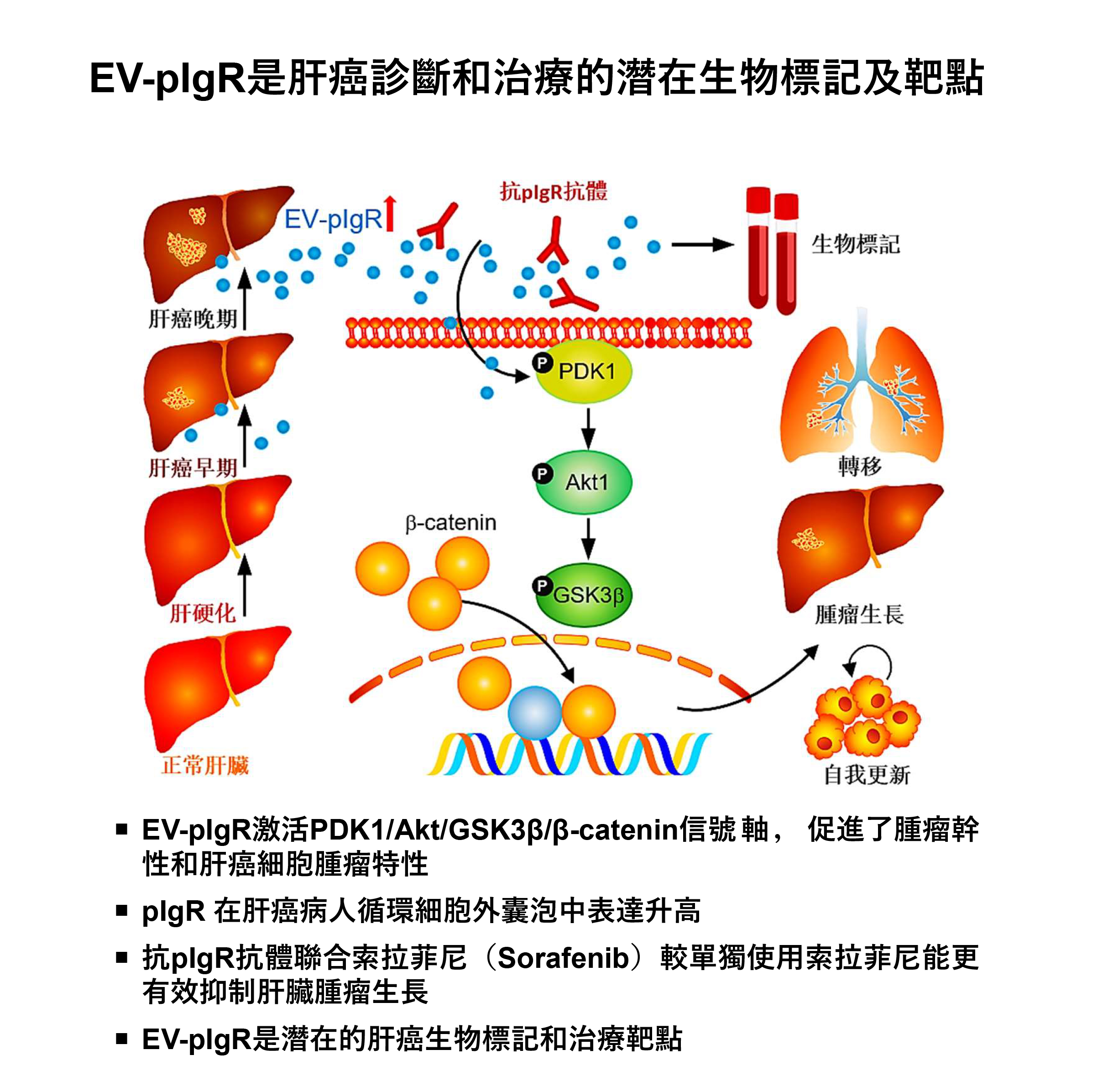 港大醫學院研究團隊揭示了肝癌患者體內循環細胞外囊泡在腫瘤轉移的過程中前所未知的重要作用。