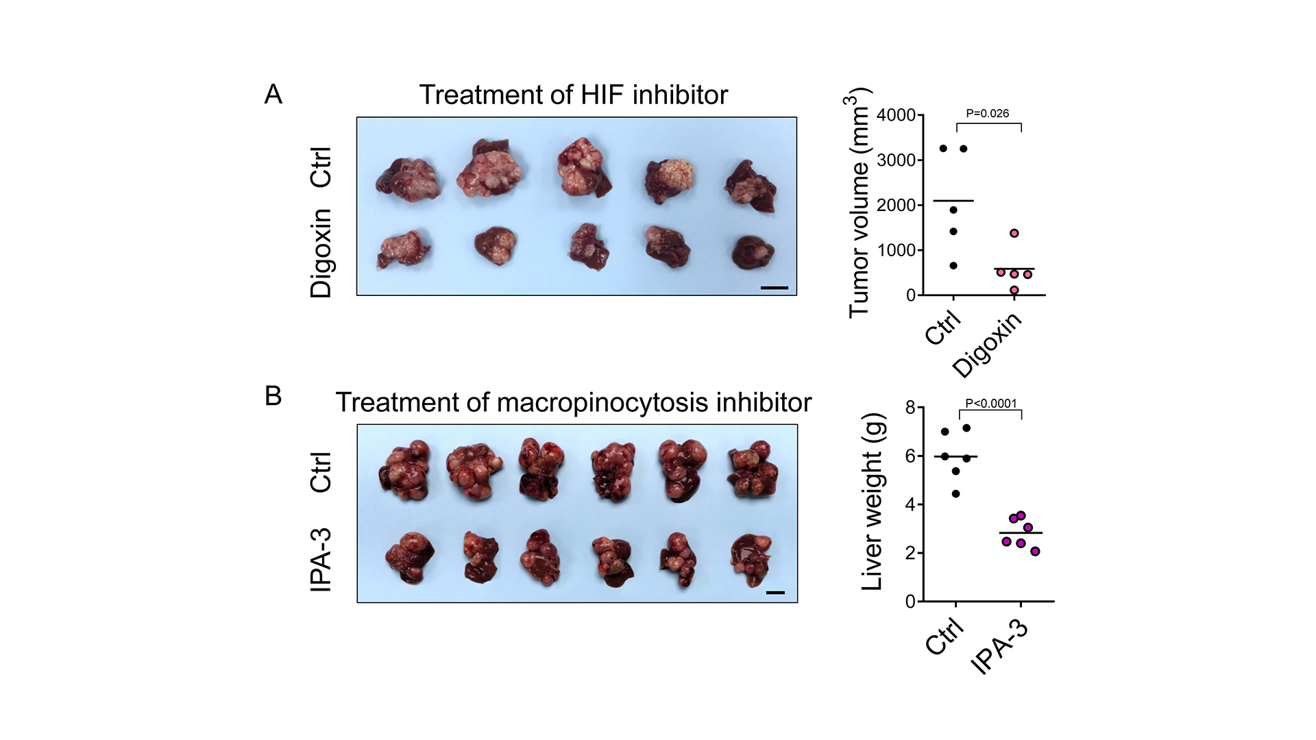 HKUMed discovers a new metabolic route for liver cancer  paving the way for new therapeutic opportunities