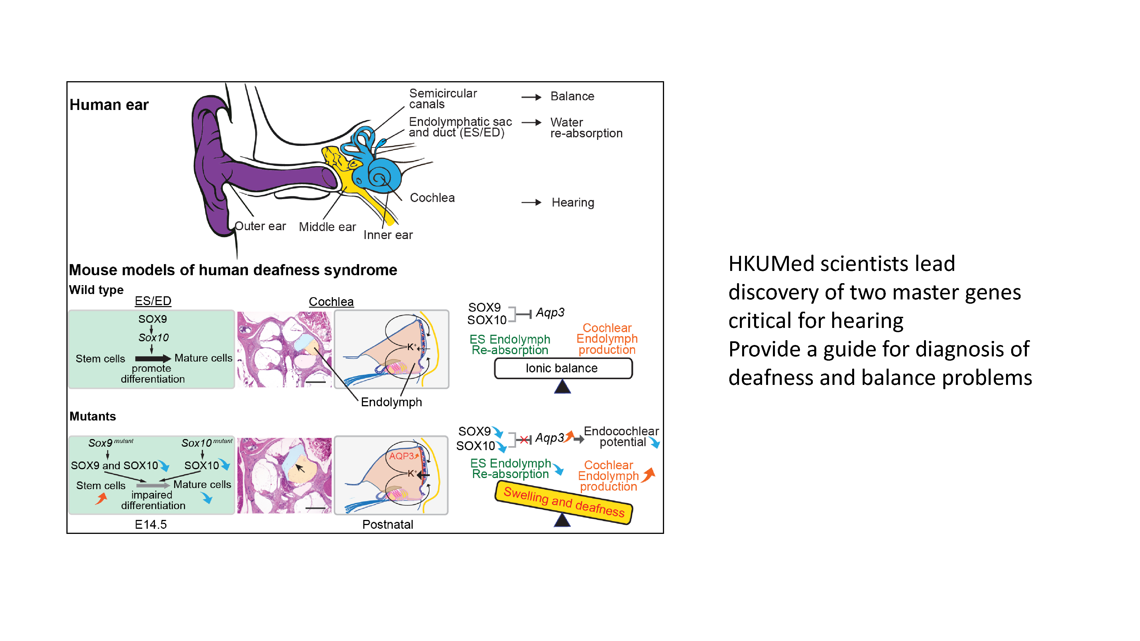 HKUMed scientists lead discovery of two master genes critical for hearing, providing a guide for diagnosis of deafness and balance problems