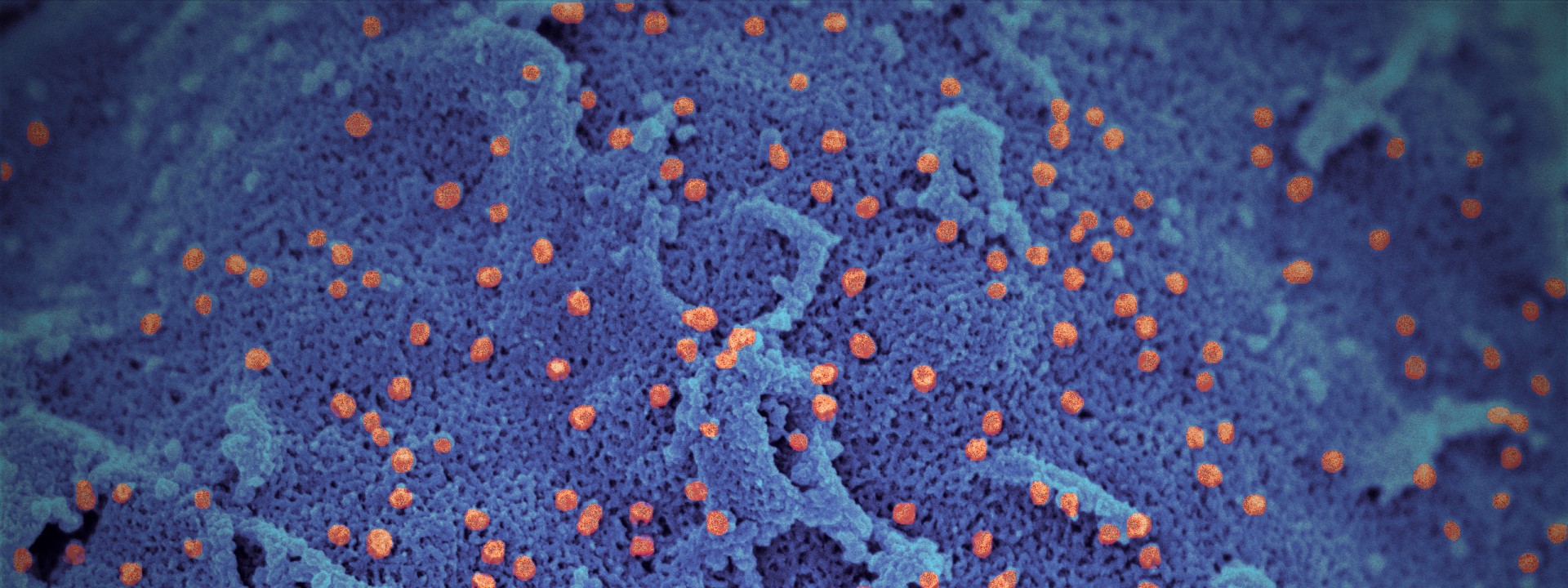 Microscopic view of the SARS-CoV-2 virus.